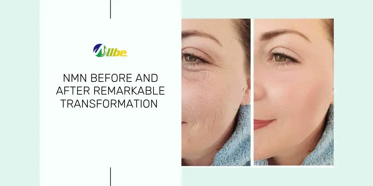 Nmn Before And After Remarkable Transformation Allbe Canada