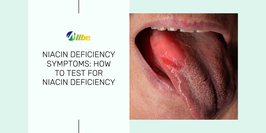 Niacin defiency symptoms: How to test for Niacin Deficiency