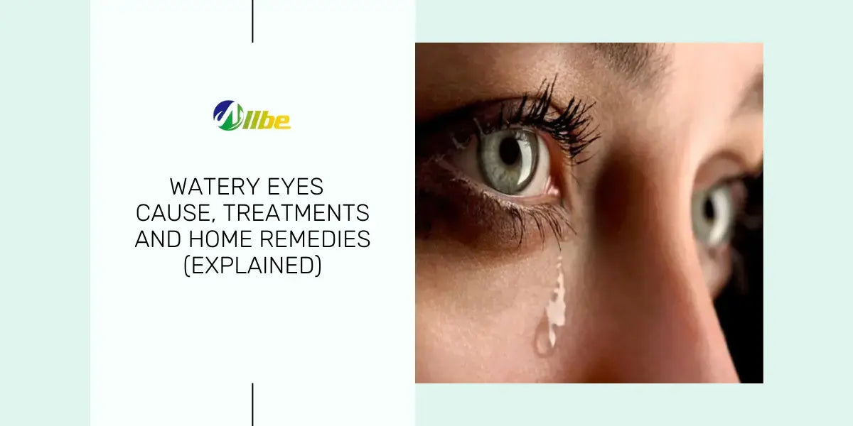 Watery Eyes Cause, Treatments, and Home Remedies (Explained) Allbe